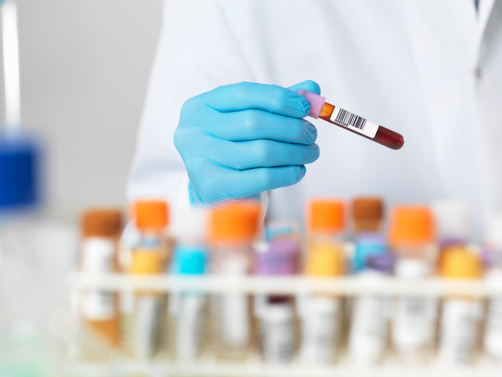 Close up of scientists hands selecting a blood sample